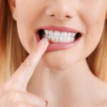 The Connection Between Acid Reflux And Dental Erosion